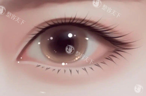 眼综合.webp.jpg