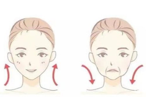 面部提升卡通对比图.jpg