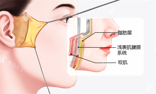 面部拉皮层次.png
