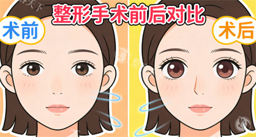 双眼皮前后.jpg