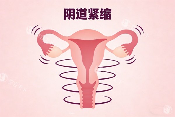 有没有人做紧缩手术后悔了 做完后不满意应该怎么修复处理