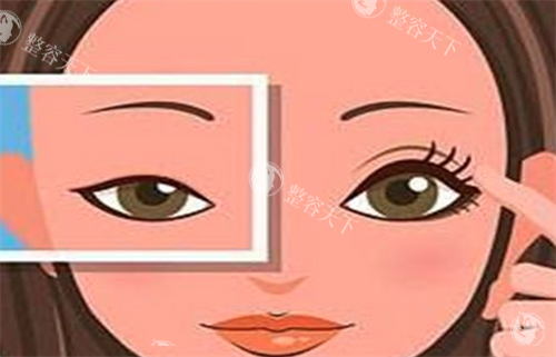 双眼皮对比.png