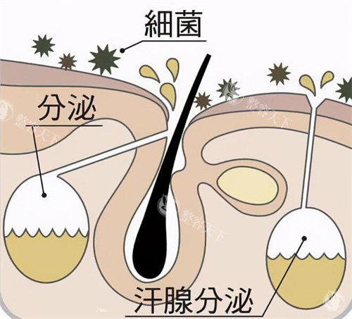 腋臭是怎么形成的.jpg