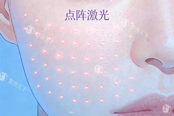 点阵激光概念图展示.jpg