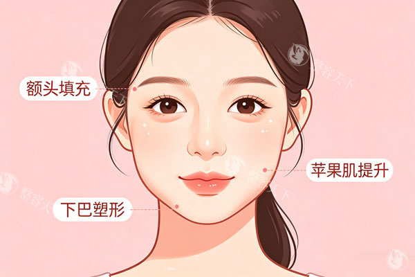 玻尿酸面部提升示意图.jpg