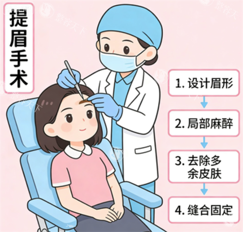 提眉手术过程.png