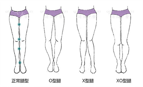 上海直腿术好医生大揭秘！卢九宁、李奇军等领衔，very 美学小程序助你选对医生！