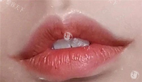微笑唇照片